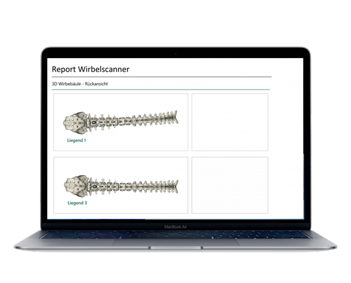 Effektiver Wirbelscanner